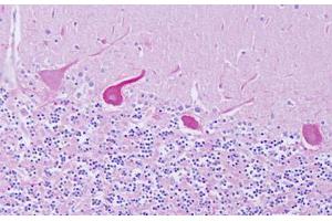 Image no. 2 for anti-GEM Interacting Protein (GMIP) (AA 804-853) antibody (ABIN6749798) (GMIP antibody  (AA 804-853))