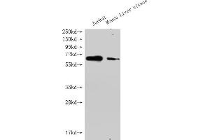 Western Blot Positive WB detected in: GPC3 antibody at 1:1000 Lane 1: Jurkat whole cell lysate Lane 2: Mouse liver tissue Secondary Goat polyclonal to Mouse IgG at 1/20000 dilution Predicted band size: 65-70KDa Observed band size: 65-70 KDa Exposure time: 5 min (Histone 3 antibody  (AA 25-559))