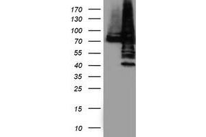Western Blotting (WB) image for anti-Protein Disulfide Isomerase Family A, Member 4 (PDIA4) antibody (ABIN1500108) (PDIA4 antibody)