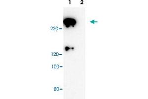 Western blot analysis of Scrib polyclonal antibody . (SCRIB antibody)