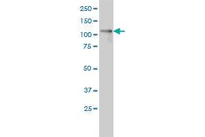 PKD1L2 monoclonal antibody (M01A), clone 3F6 Western Blot analysis of PKD1L2 expression in Hela . (PKD1L2 antibody  (AA 1-306))