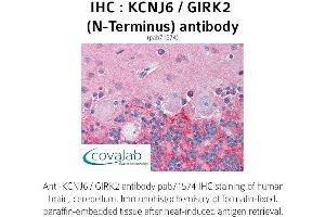Image no. 1 for anti-Potassium Inwardly-Rectifying Channel, Subfamily J, Member 6 (KCNJ6) (N-Term) antibody (ABIN1736185) (KCNJ6 antibody  (N-Term))