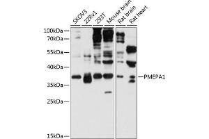 Western blot analysis of extracts of various cell lines, using PMEP antibody (2171) at 1:3000 dilution. (PMEPA1 antibody  (AA 173-252))