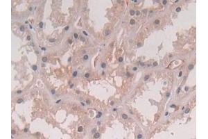Immunohistochemistry (IHC) image for anti-Interleukin 5 (IL5) (AA 20-134) antibody (ABIN7430837)