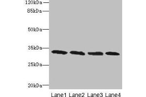 Western blot All lanes: PNP antibody at 16 μg/mL Lane 1: Jurkat whole cell lysate Lane 2: K562 whole cell lysate Lane 3: U937 whole cell lysate Lane 4: 293T whole cell lysate Secondary Goat polyclonal to rabbit IgG at 1/10000 dilution Predicted band size: 33 kDa Observed band size: 33 kDa (PNP antibody  (AA 1-289))
