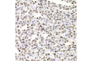 Immunohistochemistry of paraffin-embedded rat kidney using SOX5 antibody at dilution of 1:100 (x400 lens). (SOX5 antibody)