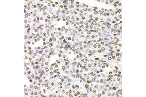 Immunohistochemistry of paraffin-embedded rat kidney using SOX5 antibody at dilution of 1:100 (x400 lens).