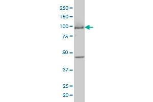 MCM3 monoclonal antibody (M01A), clone 4F7 Western Blot analysis of MCM3 expression in COLO 320 HSR . (MCM3 antibody  (AA 699-808))