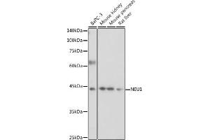 Western blot analysis of extracts of various cell lines, using NEU1 antibody (ABIN6129462, ABIN6144538, ABIN6144539 and ABIN6221903) at 1:1000 dilution. (NEU1 antibody  (AA 156-415))