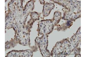 Image no. 2 for anti-5'-Nucleotidase, Cytosolic II (NT5C2) (AA 1-562) antibody (ABIN599188) (NT5C2 antibody  (AA 1-562))
