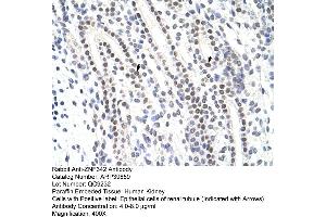 anti-Zinc Finger Protein 296 (ZNF296) (C-Term) antibody