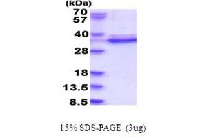 SDS-PAGE (SDS) image for Cyclin-Dependent Kinase 2 (CDK2) (AA 1-298) protein (His tag) (ABIN7280826)