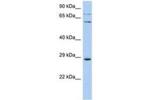 ZNF490 Antikörper  (AA 107-156)