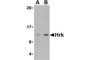 Image no. 1 for anti-Harakiri, BCL2 Interacting Protein (Contains Only BH3 Domain) (HRK) (Middle Region) antibody (ABIN318751) (HRK antibody  (Middle Region))