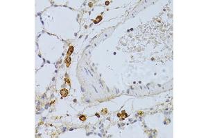 Immunohistochemistry of paraffin-embedded rat lung using PHGDH antibody (ABIN4904748) at dilution of 1:100 (40x lens). (PHGDH antibody)