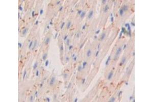 Used in DAB staining on fromalin fixed paraffin- embedded Kidney tissue (Corin antibody  (AA 807-1038))