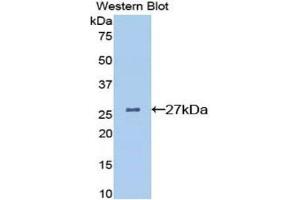 Western Blotting (WB) image for anti-Clusterin (CLU) (AA 227-448) antibody (ABIN1077938) (Clusterin antibody  (AA 227-448))