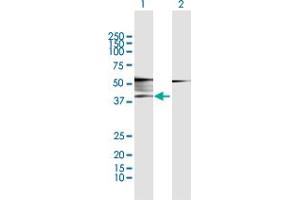 Western Blot analysis of ADRB2 expression in transfected 293T cell line by ADRB2 MaxPab polyclonal antibody. (beta 2 Adrenergic Receptor antibody  (AA 1-413))