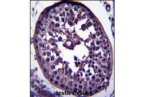 GAGE12H Antibody (N-term) (ABIN657560 and ABIN2846567) immunohistochemistry analysis in formalin fixed and paraffin embedded human testis tissue followed by peroxidase conjugation of the secondary antibody and DAB staining. (G Antigen 12H antibody  (N-Term))