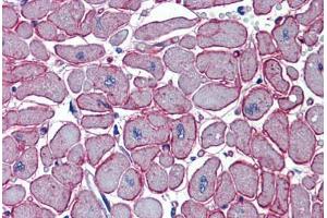 Human Heart (formalin-fixed, paraffin-embedded) stained with DCST1 antibody ABIN462239 followed by biotinylated goat anti-rabbit IgG secondary antibody ABIN481713, alkaline phosphatase-streptavidin and chromogen. (DCST1 antibody  (C-Term))