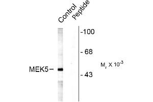 Western blots of rat testes lysate showing specific labeling of the ~49k MEK5 protein (Control).