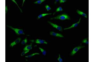 Immunofluorescence staining of Hela cells with ABIN7169960 at 1:100, counter-stained with DAPI. (SLC5A8 antibody  (AA 540-610))