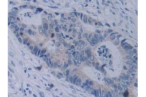 Immunohistochemistry (IHC) image for anti-Neuropilin 2 (NRP2) (AA 231-490) antibody (ABIN7435322)