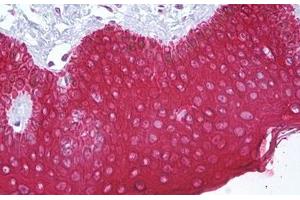 Anti-KRT10 / Cytokeratin 10 antibody IHC staining of human skin, epidermis. (Keratin 10 antibody  (AA 136-185))