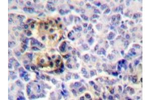 Immunohistochemistry analyzes of Moesin antibody in paraffin-embedded human pancreas tissue. (Moesin antibody)