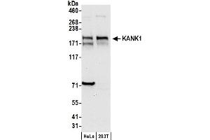 anti-Ankyrin Repeat Domain 15 (ANKRD15) (AA 1302-1352) antibody