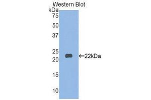 Western Blotting (WB) image for anti-Myosin, Light Chain 3 (MYL3) (AA 5-181) antibody (ABIN1859940) (MYL3/CMLC1 antibody  (AA 5-181))
