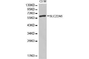 Western blot analysis of extracts of CEM cell lines, using SLC22A6 antibody. (SLC22A6 antibody)
