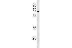 HAS3 antibody western blot analysis in A549 lysate. (HAS3 antibody  (AA 137-164))