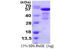 SDS-PAGE (SDS) image for SHC (Src Homology 2 Domain Containing) Transforming Protein 1 (SHC1) (AA 1-474) protein (His tag) (ABIN667498)