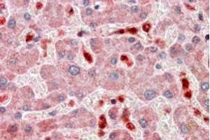 Immunohistochemistry (IHC) image for anti-PYD and CARD Domain Containing (PYCARD) (C-Term) antibody (ABIN184674)