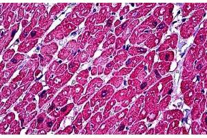 Human Heart: Formalin-Fixed, Paraffin-Embedded (FFPE) (TNNC1 antibody)