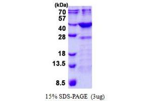Image no. 1 for Fructosamine 3 Kinase (FN3K) protein (His tag) (ABIN1098503)