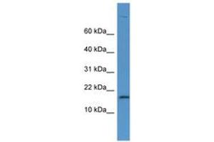 Image no. 1 for anti-Lysozyme (LYZ) (AA 48-97) antibody (ABIN6746797) (LYZ antibody  (AA 48-97))