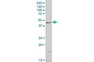 NEU1 polyclonal antibody (A01), Lot # 060703JCS1. (NEU1 antibody  (AA 334-415))