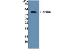 Detection of Recombinant NCAM, Human using Polyclonal Antibody to Cluster Of Differentiation 56 (CD56) (CD56 antibody  (AA 340-608))