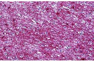 Human Brain, Cortex: Formalin-Fixed, Paraffin-Embedded (FFPE)