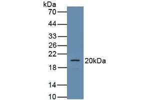 Detection of Recombinant PCX, Rat using Polyclonal Antibody to Podocalyxin (PODXL) (PODXL antibody  (AA 408-485))