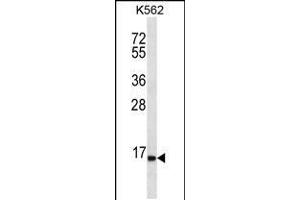 Western blot analysis in K562 cell line lysates (35ug/lane). (SPINK8 antibody  (C-Term))