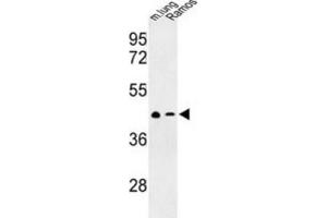 Western Blotting (WB) image for anti-Chemokine (C-X-C Motif) Receptor 7 (CXCR7) antibody (ABIN3003904) (CXCR7 antibody)