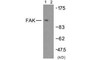 Western blot analysis of extracts from HeLa cells using FAK (Ab-925) antibody (E021148). (FAK antibody)