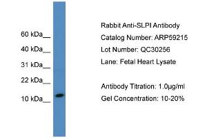 WB Suggested Anti-SLPI  Antibody Titration: 0. (SLPI antibody  (N-Term))