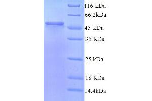 LMAN1L Protein (AA 26-462) (His tag)
