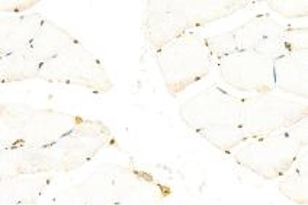 CSHL1 antibody