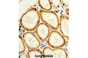 Immunohistochemistry (IHC) image for anti-Caspase 2, Apoptosis-Related Cysteine Peptidase (CASP2) antibody (ABIN2997249) (Caspase 2 antibody)
