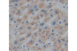 IHC-P analysis of Human Tissue, with DAB staining. (LACTB antibody  (AA 313-547))